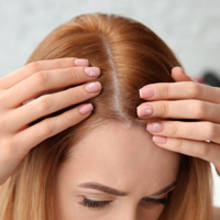 الحالات التي لا ينصح فيها اجراء عملية زراعة الشعر