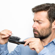 How to know if you are becoming bald, and how to prevent it
