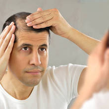 Seasonal hair loss: When and why does it happen?