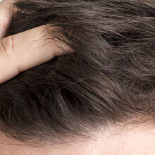 Hair Transplant Turkey 2024: Your Guide to the Best Clinics and Surgeons