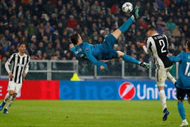 زراعة الشعر والرياضة وكمال الاجسام