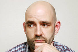 حالات واسباب فشل عملية زراعة الشعر