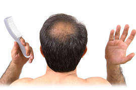 كيفية الحفاظ على الشعر الأصلي من التساقط