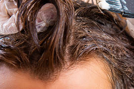 ¿Cuándo puede teñirse el pelo después de un trasplante capilar?