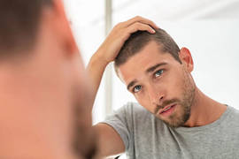 Alopecia difusa, ¿qué es, cuál es la causa y qué tratamiento tiene?