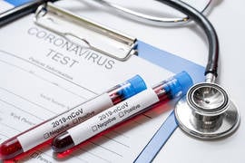 Le coronavirus et l’alopécie : quelle liaison?