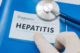 ¿Puedo realizar un trasplante capilar si tengo hepatitis C?