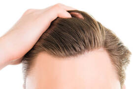 Greffe cheveux istanbul