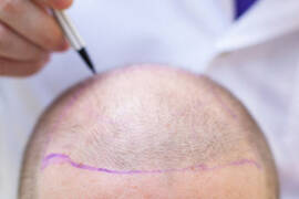 على ماذا يعتمد بقاء البصيلات