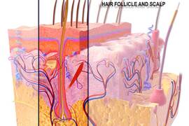 Unités folliculaires et greffe de cheveux