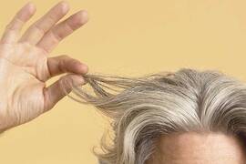 كم يبلغ عدد الشعر الذي يتساقط يومياً؟ ماهي النسبة التي يكون فيها تساقط الشعر شديد جداً