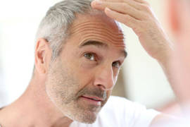 ¿Es viable un trasplante capilar con canas?