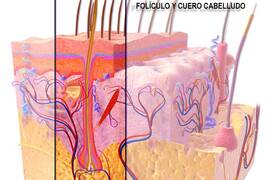 Unidades foliculares y trasplante capilar