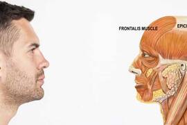 الصفاق القحفي و تساقط الشعر