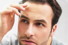 تصّغر الشعر: أعراضه ، التشخيص ، و العلاج