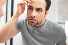 Hair Miniaturization: signs, diagnosis, and treatment