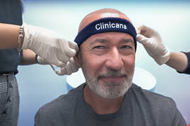 Choosing the Best Hair Transplant Clinic in Istanbul