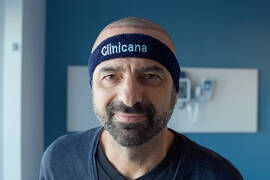 Top 10 Hair Transplant Clinics in Turkey