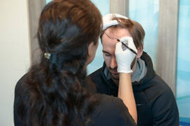 تكلفة زراعة الشعر في تركيا