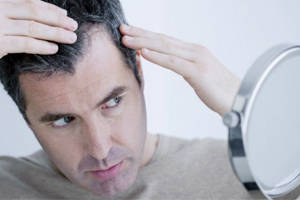 Hair falling after hair transplant operation