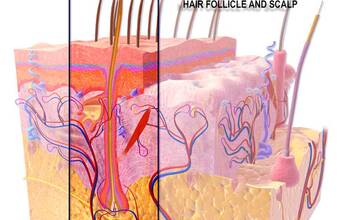 Unités folliculaires et greffe de cheveux