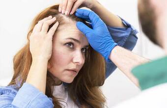 Moterims Pasitaikantis Vyrams Būdingas Androgeninis Plikimas: Požymiai ir gydymas