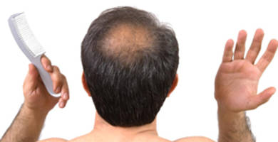 كيفية الحفاظ على الشعر الأصلي من التساقط