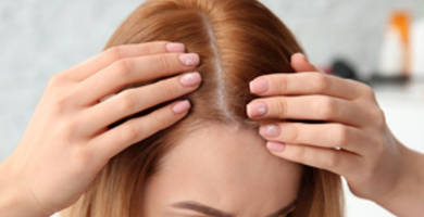 الحالات التي لا ينصح فيها اجراء عملية زراعة الشعر