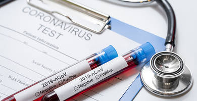 Are coronavirus and alopecia related each other?