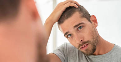 Diffus alopeci: orsaker och behandling