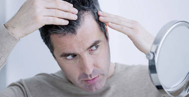 What is telogen effluvium? Does it have a treatment?