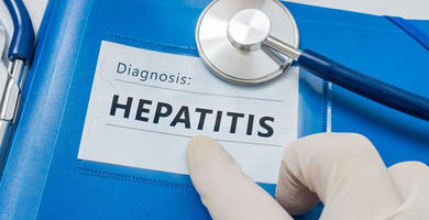 ¿Puedo realizar un trasplante capilar si tengo hepatitis C?