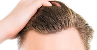 Greffe cheveux istanbul