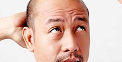 Minoxidil: resultados y efectos secundarios