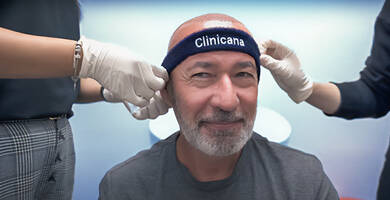 Choosing the Best Hair Transplant Clinic in Istanbul