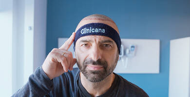 Recovery Tips After Hair Implantation