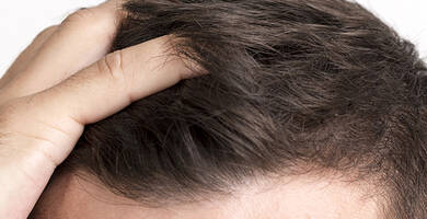 Hair Transplant Turkey 2024: Your Guide to the Best Clinics and Surgeons