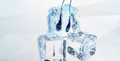 Ice grafts hair transplant technique