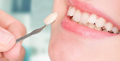 قشور الأسنان البورسلانية (فينير الأسنان)