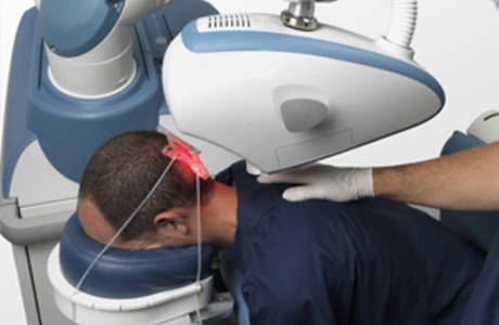 Sistema robótico de trasplante capilar