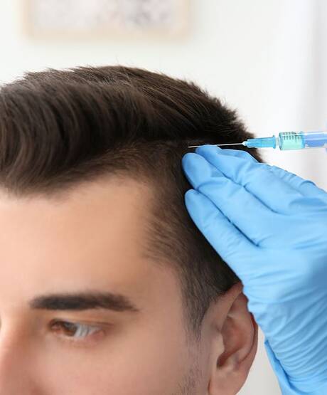 Причины и лечение треугольной алопеции