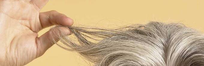 كم يبلغ عدد الشعر الذي يتساقط يومياً؟ ماهي النسبة التي يكون فيها تساقط الشعر شديد جداً