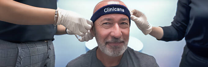 Choosing the Best Hair Transplant Clinic in Istanbul