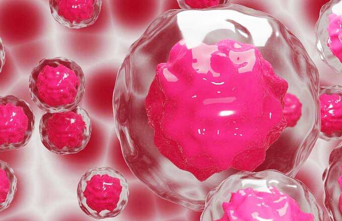 Проучване  на стволови клетки за растеж на косата: лекът за алопеция е близо