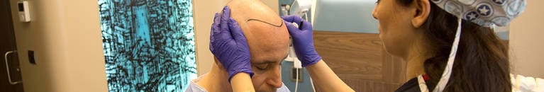 Пересадка волос методом фолликулярного извлечения волоса