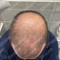 After 2 weeks