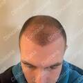 After 2 months