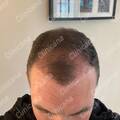 after 4 months