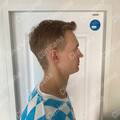 Result after 7 months