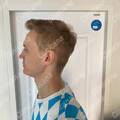 Result after 7 months